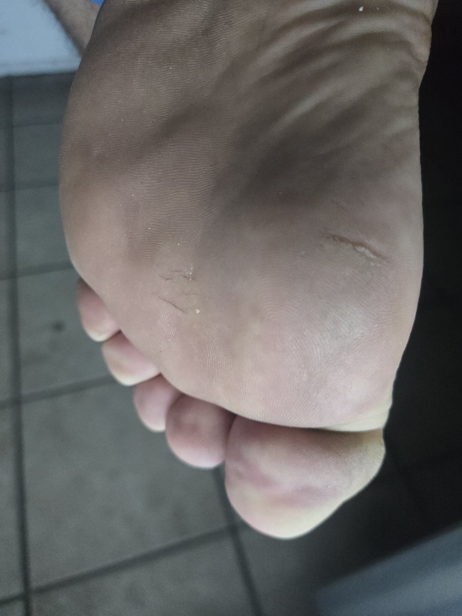 ChunkyPads's tweet photo. FAT SOLES Before 🤭 &amp; After 😈 Saturday Morning Barefoot Walk. Which do you prefer?
[10.5-11 US, 6'2", 300LB]
#MeatyFeet #ChubbyFeet #WideFeet #MaleSoles #FootFetish #BearFeet https://t.co/3eqWqTAxbW
