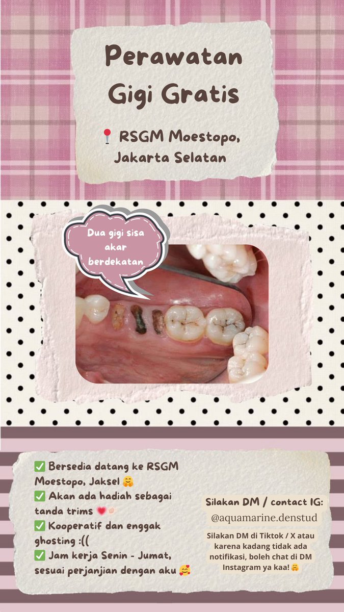 alzeswan's tweet photo. Haii aku koas gigi yang cari pasien dg dua gigi sisa akar berdekatan!

1. Perawatan gigi (gratis) dilakukan oleh dokter gigi muda (koas) di RSGM Moestopo, Jaksel
2. Bersedia datang pd hari kerja (senin-jumat) pada jam 08.00-14.30 sesuai perjanjian 🤗

#caripasien #koasgigi https://t.co/1jtT8ZGGNb