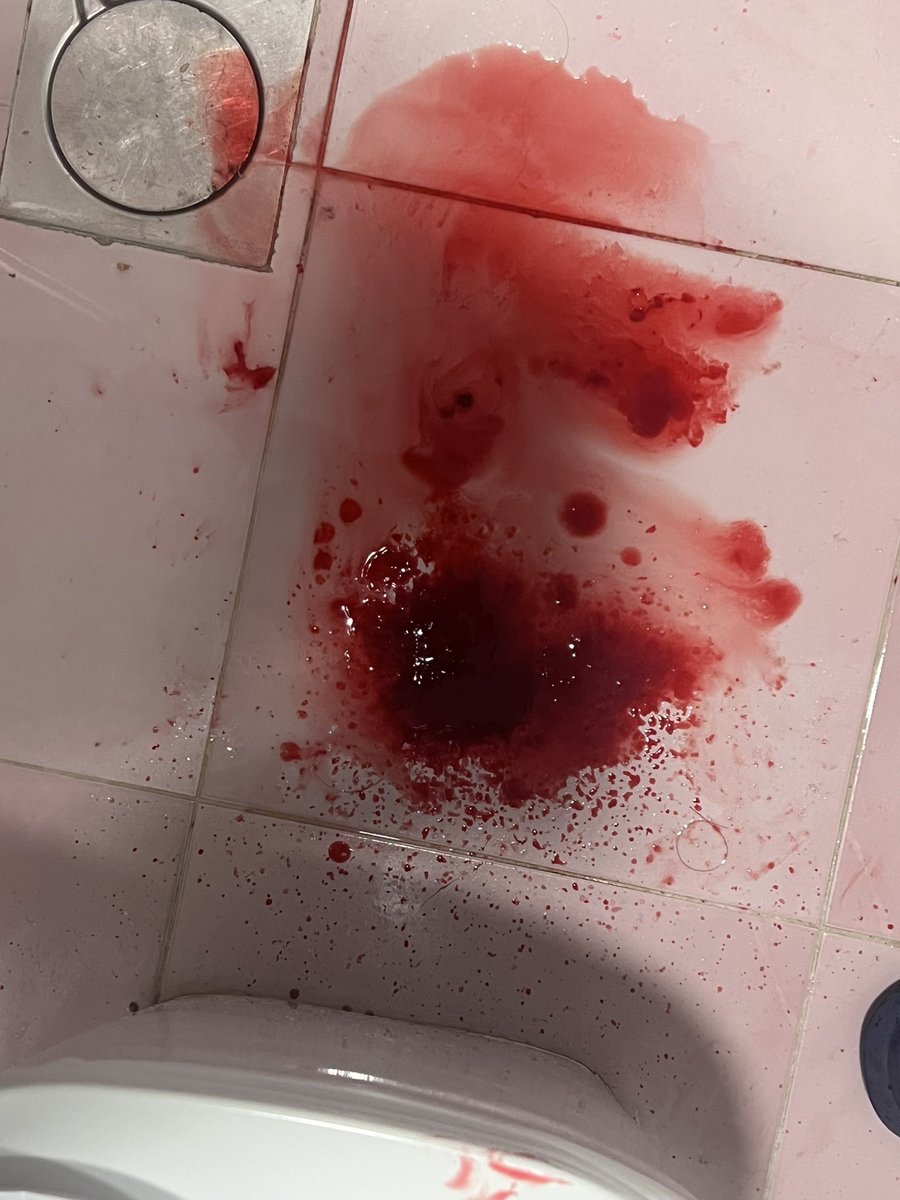 dtjcli's tweet photo. The aftermath of the fake makeup. So much fake blood on the floor.

FAKE EVERYTHING!

#fake #sfwmakeup https://t.co/kE85DxW98R