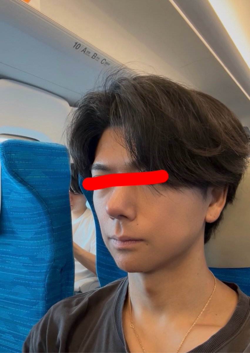 Rvb_Twins's tweet photo. スキンケアでどのくらい変わるかって
・抗炎症
・��脂抑制

真夏にでもこれだけ出来る

この方は次の目標は「毛穴縮小」 https://t.co/MjtIGhHj9w