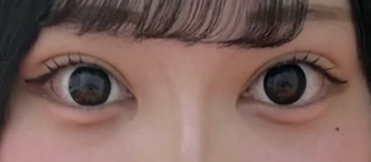 3jbtsuo's tweet photo. 人生変わったありがとうჱ̒՞ ̳ᴗ ̫ ᴗ ̳՞꒱

 #整形  #二重   #二重整形 https://t.co/DXkhEwEy3B