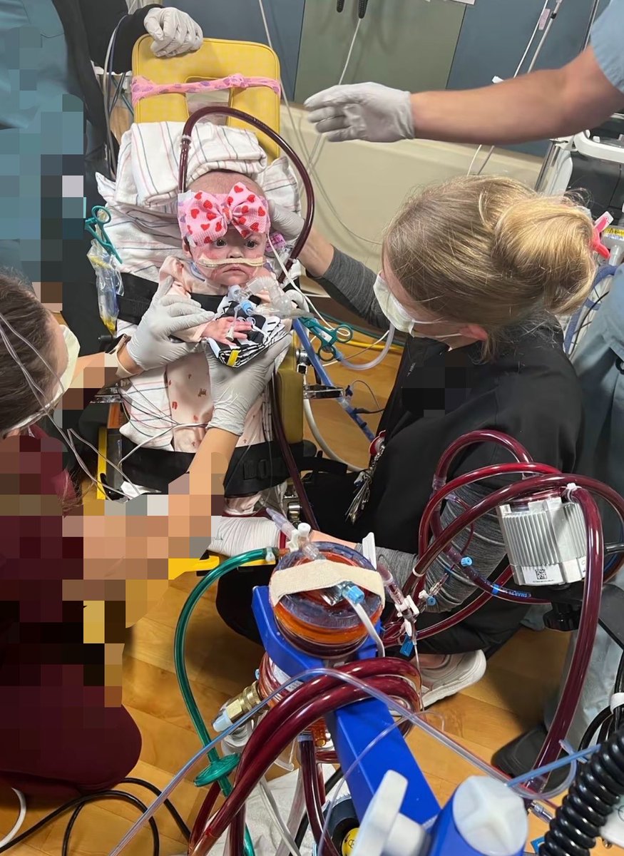 RTshen1's tweet photo. Aubrey’s story 

At just 4 months old, she developed severe RSV infection complicated by necrotizing pneumonia, PARDS &amp; cardiogenic shock

She initially required VA-ECMO. As her cardiac function improved but her lungs remained severely injured, she was transitioned to VV-ECMO https://t.co/0EYTdwYF0j