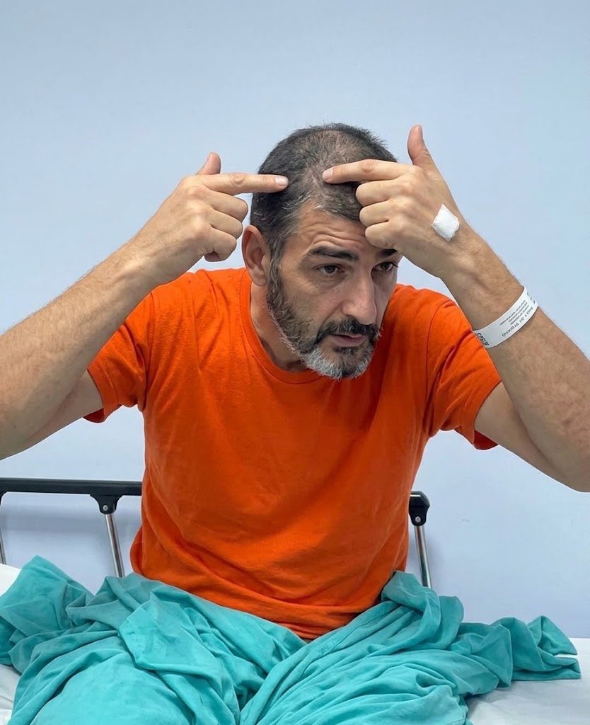 MemeBipoIar's tweet photo. Mire la evidencia, me destaparon el cerebro, me pegaron un piedrazo acá en la masa cefálica, me machetearon… https://t.co/FjFJIMTg20
