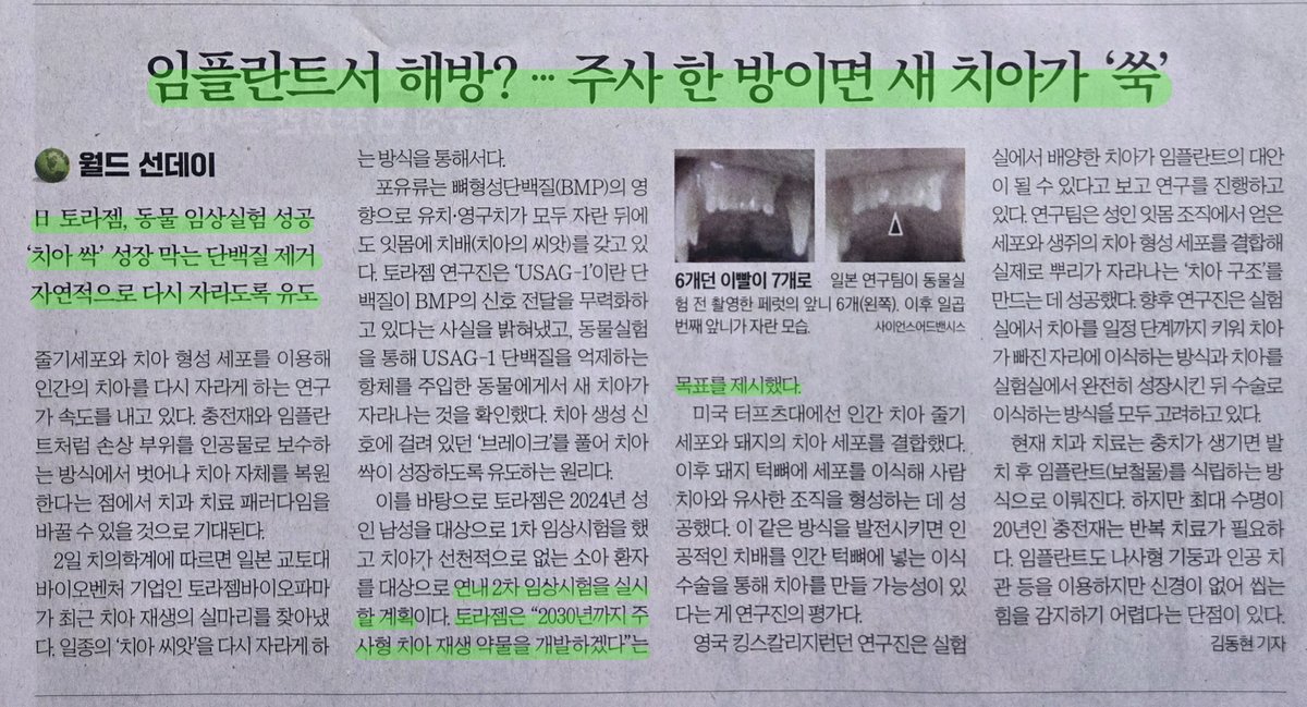 Myeongsu_bean's tweet photo. 제가 기술발전을 항상 눈여겨보는 이유입니다. 만약 이 기술이 상용화된다면 임플란트 기업들은 싹 망할지도 모르겠습니다. 

치아를 새로 나게 만드는 주사가 개발중이랍니다. 예~전에 만든다 만다 하는 기사를 본 거 같은데 벌써 임상2상을 준비중이라고 하니 2030년 전에는 나올 수도 있겠습니다. 

나오면..? 비단 임플란트 대체용으로만 사용될까요? 치아가 누래지거나 충치가 생기거나 하면 그냥 뽑아버리고 새 치아가 나게 하지 않을까요? 

치아 관련 약이나 보철물들 전부 싹 망할 수 있겠습니다. 

이런 신기술 하나가 전체 산업을 무너뜨리는 겁니다. 이래서 투자자는 기술개발에 예민해져야 합니다.

글 잘 보셨다면 좋아요 😊.

기사출처: 한국경제