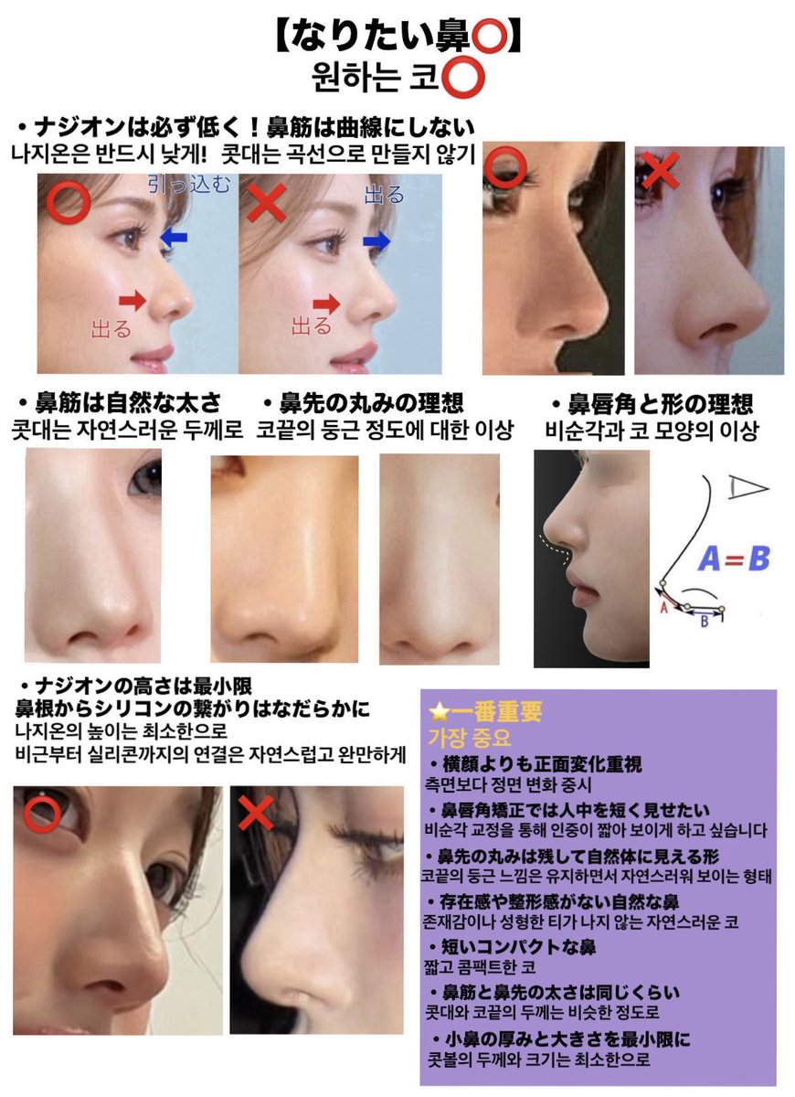 Nhhblj's tweet photo. 鼻整形のカウンセリングで用意した資料⬇️ https://t.co/LbMGxxsc91