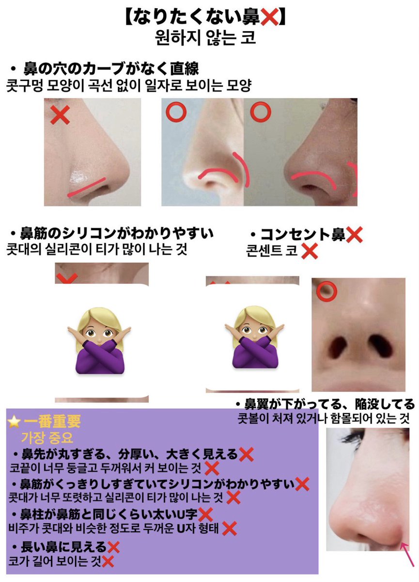 Nhhblj's tweet photo. 鼻整形のカウンセリングで用意した資料⬇️ https://t.co/LbMGxxsc91