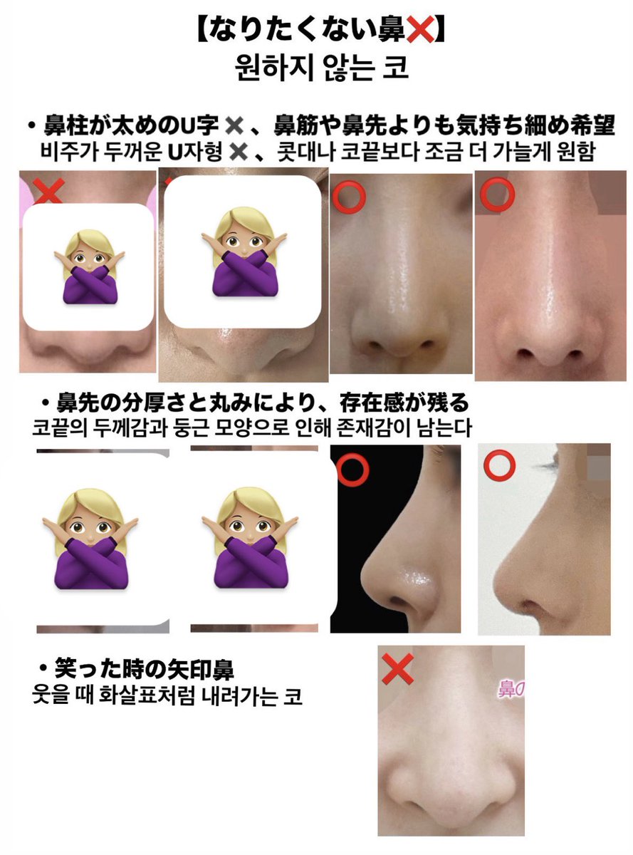 Nhhblj's tweet photo. 鼻整形のカウンセリングで用意した資料⬇️ https://t.co/LbMGxxsc91