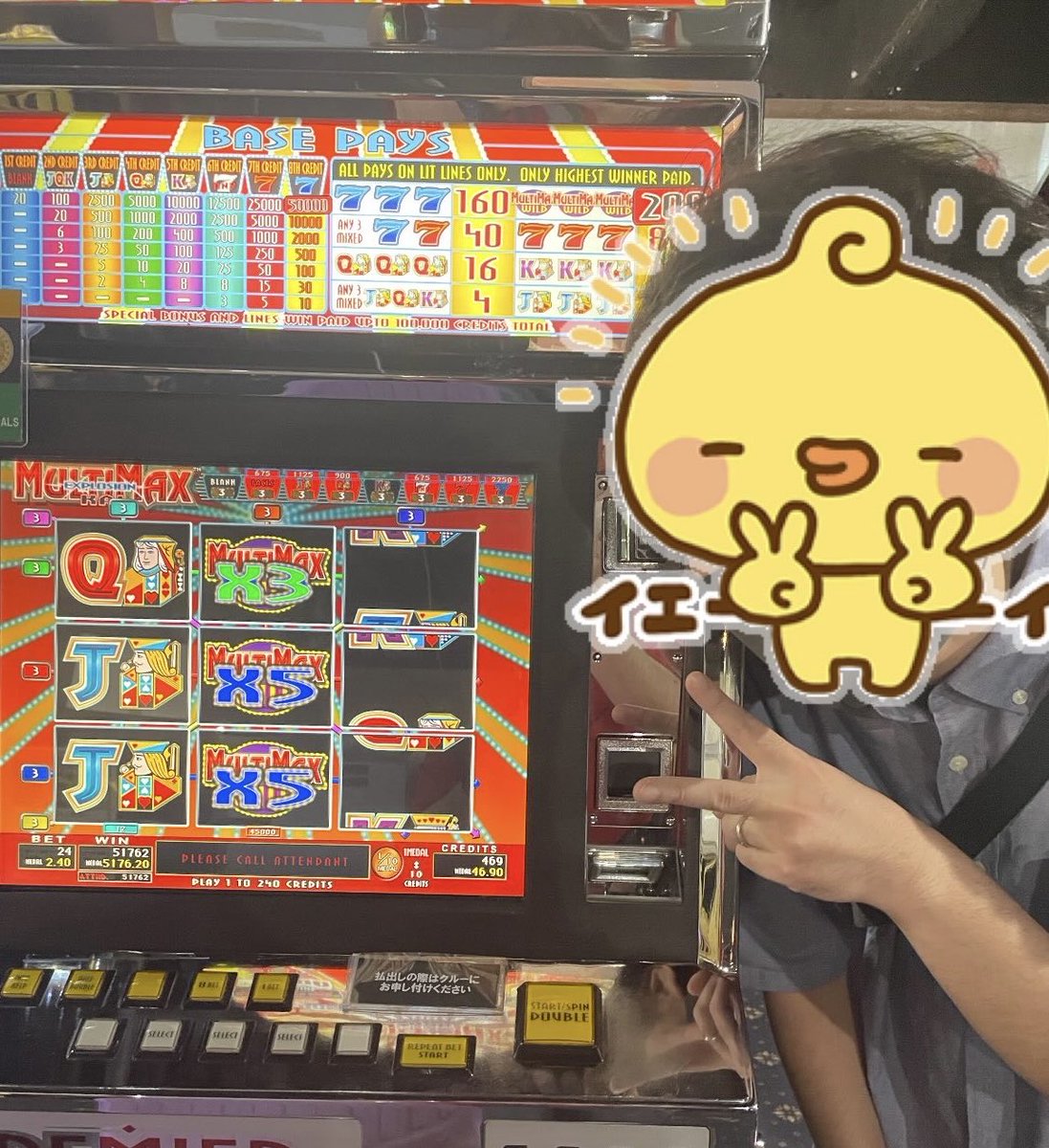 hiroking_1122's tweet photo. おっぱいブルンとスタンガンと私
#バイヨン https://t.co/2vw0lxGfXm
