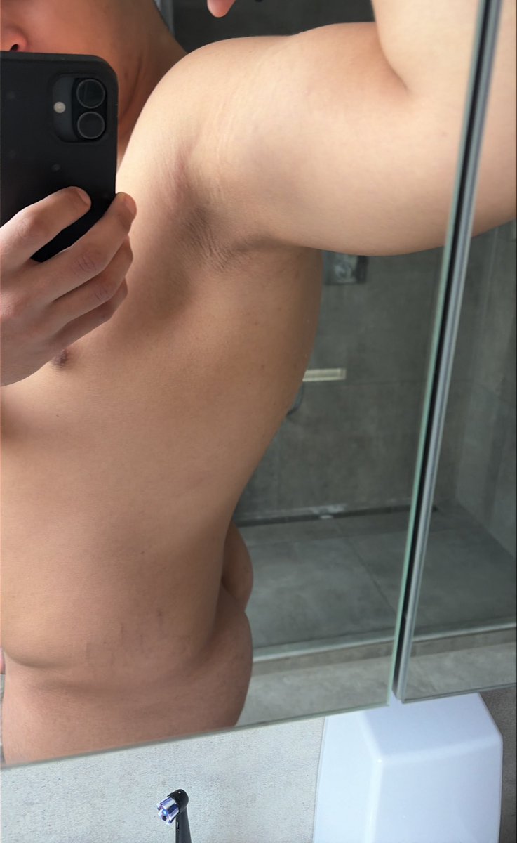 9FED4LIFE's tweet photo. @grok remove my stretch marks https://t.co/S6eZEHFb35