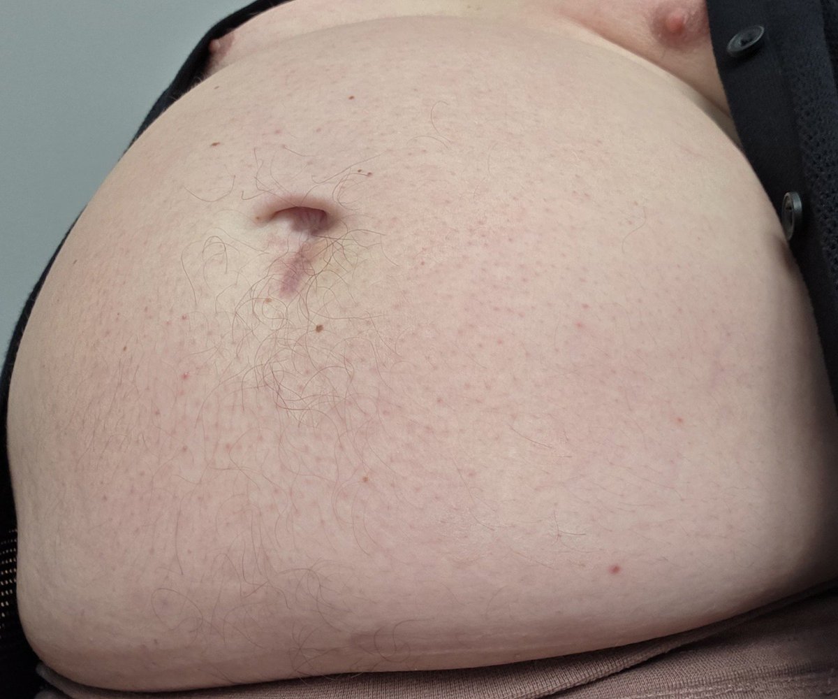 GrowingCarsten's tweet photo. Drei Blickwinkel, ein Lieblingsthema 😏 Welcher gefällt euch am besten: 1, 2 oder 3?
#feedee #bhm #bigbelly #chubby https://t.co/FBFPJIqfk0