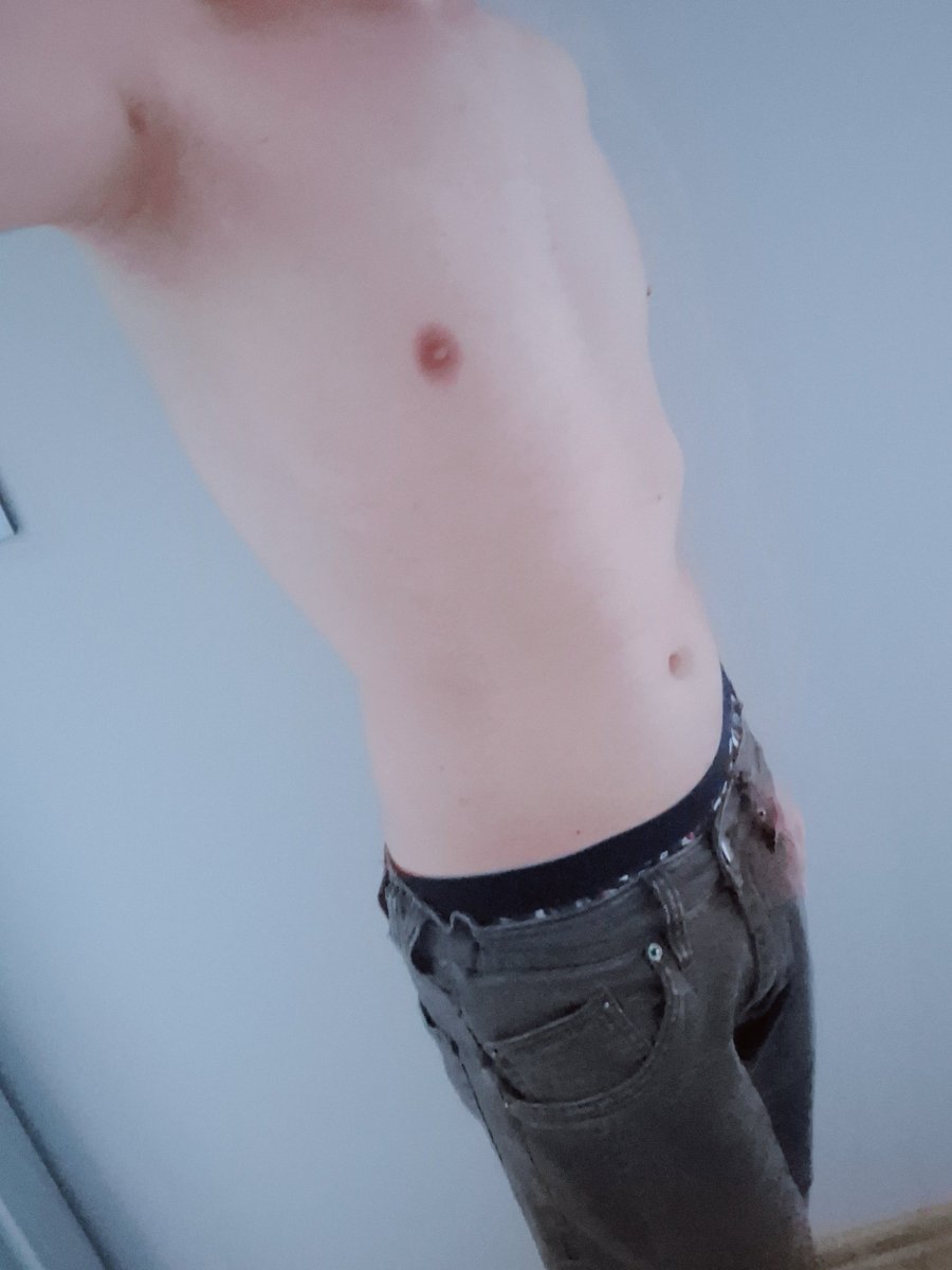 bl00dyxorange's tweet photo. my tummy https://t.co/xEcWNeibPa