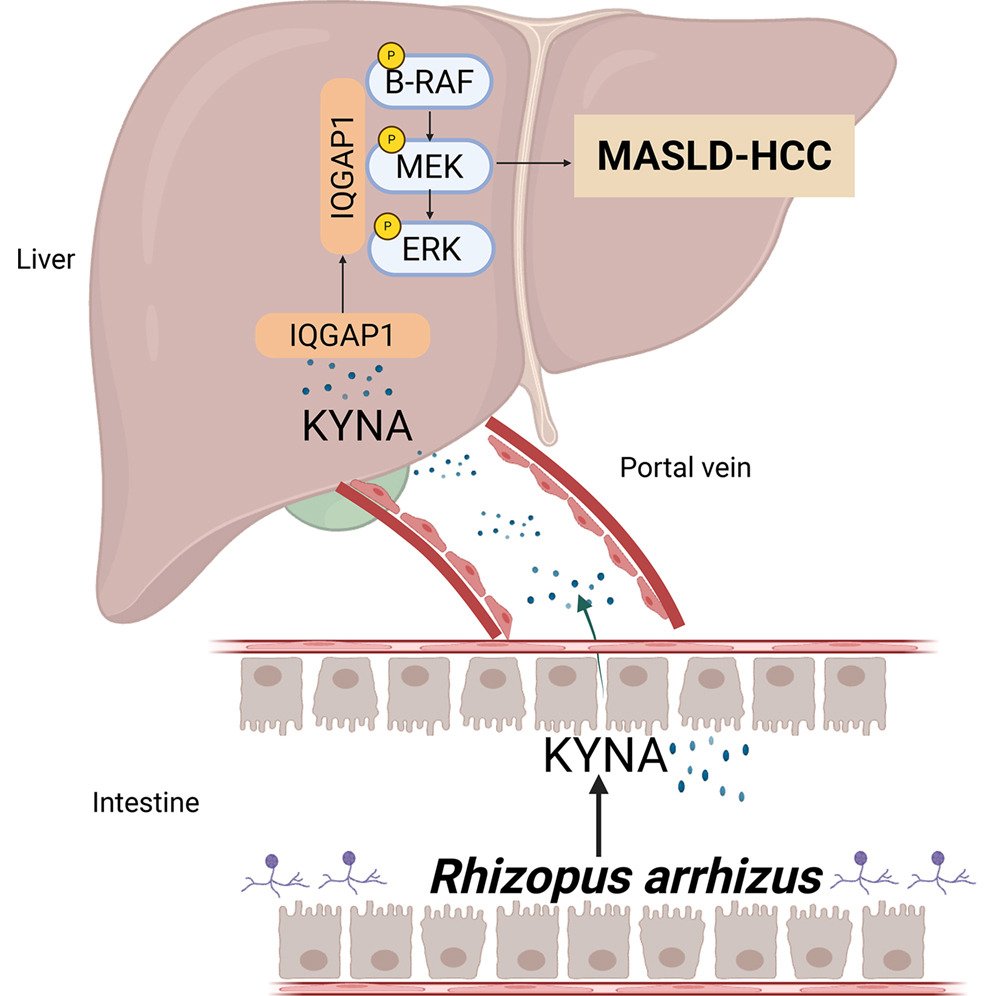 MicrobesInfect's tweet photo. Fungus Rhizopus arrhizus promotes MASLD-associated hepatocellular carcinoma through generating kynurenic acid.

Rhizopus arrhizus drives liver #cancer by producing kynurenic acid that activates MAPK signaling.

https://t.co/QvgsPA47Fe #OpenAccess #mycology https://t.co/ji6Cgv4kF1