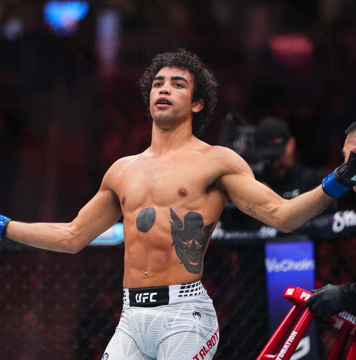 luckyfunmma's tweet photo. 🚨BREAKING NEWS🚨

Payton Talbott has been hospitalized with an injury from carrying the #UFC332 card on his back https://t.co/tav9JsmcRB