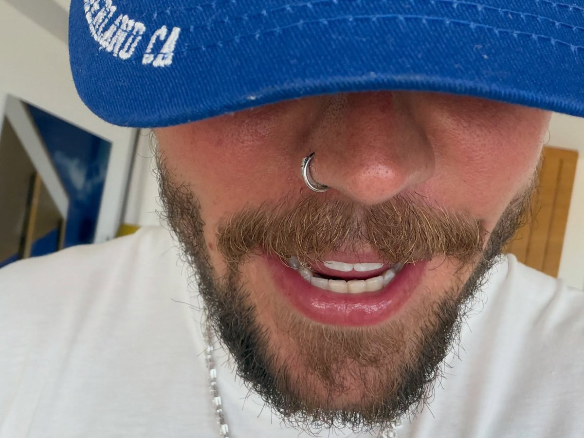 CanadianWorry's tweet photo. @aarontsuarez es el reflejo de la piel oleosa y el piercing https://t.co/CdQ0hQv5iH