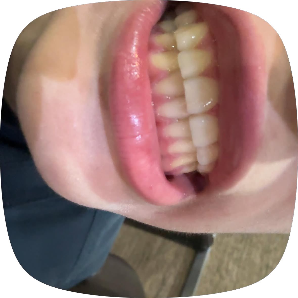 spittgg's tweet photo. https://t.co/i0nqrAxkeI
