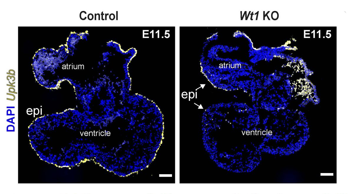 CircRes's tweet photo. Redpath et al found #WT1, the master regulator of the heart's outer layer, and its target #Sulf1, coordinate responses to incoming signals, to direct cell behavior & support heart #development. Learn more at https://t.co/HO3XQ87Pqj
@Joey_JMVieira https://t.co/sKqU1QvGqA