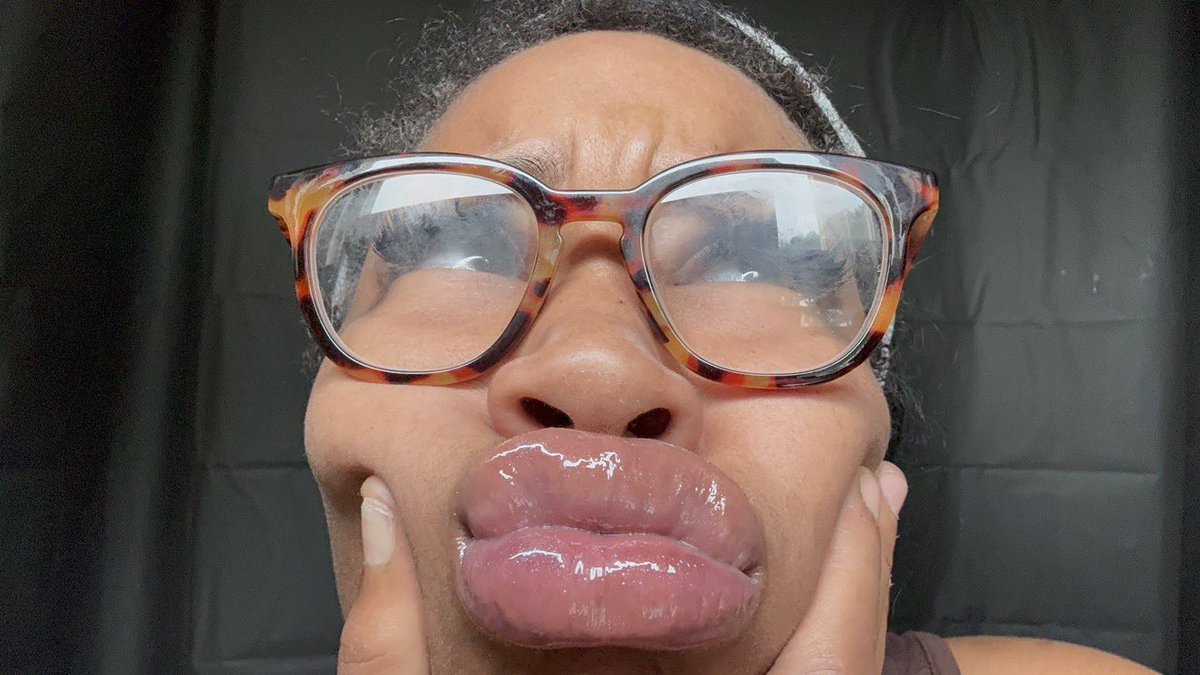 LIPSnBADDIES's tweet photo. nutty glossy goony plumpers 😵‍💫😵‍💫💦💋
-
#lips #lipgooner #DSL #biglips #lipfetish #nutty #gooner #gooning #faceporn #goonfuel #juicylips #glossy #glossylips #glasses #ebonydsl #lightskin #lightskinbaddie #goon #lipgloss #upclose #pyt #fineshit #baddies #lipgloss #kisses #bop #goon https://t.co/ncq37iCWq1