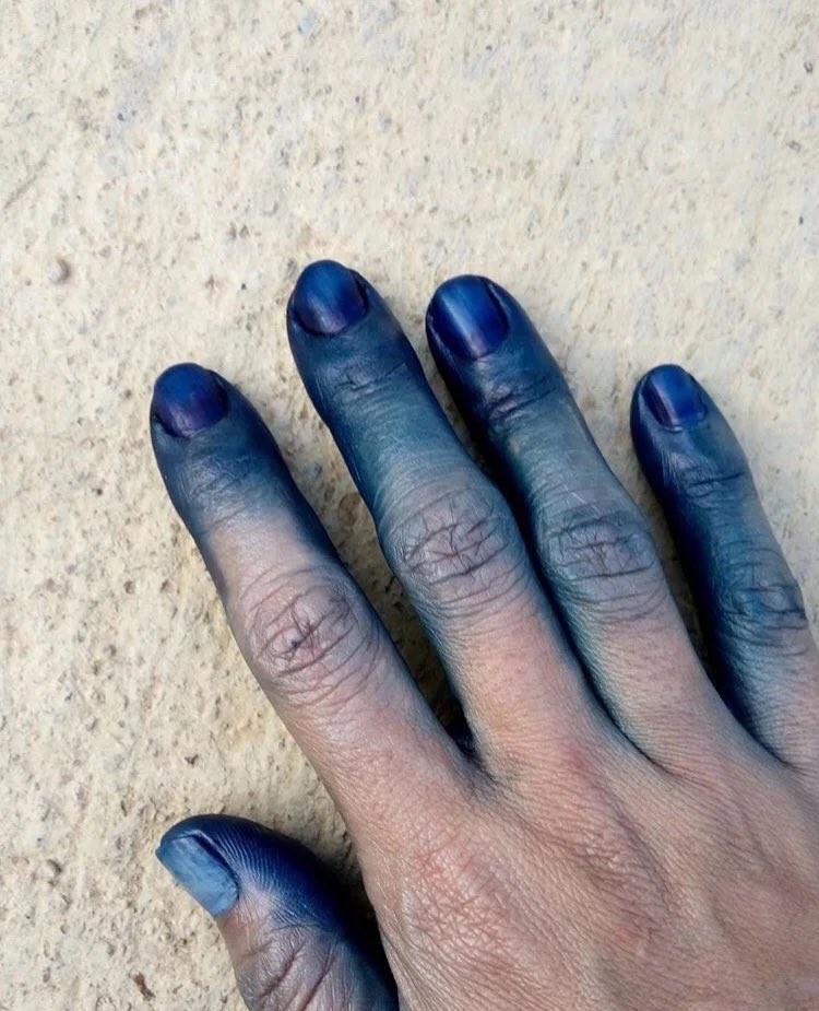 SkyboundLight's tweet photo. @Evrenrw1 Really reminicent of Elukami or Indigo fingers from indigo dyeing https://t.co/NwEVOnq07z