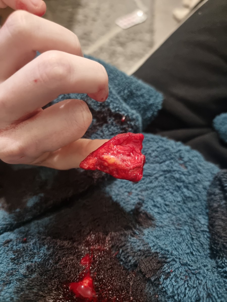 UnimportantLurk's tweet photo. Halloween makeup , certainly not real , definitely sfx . https://t.co/hvoYhGVK8I