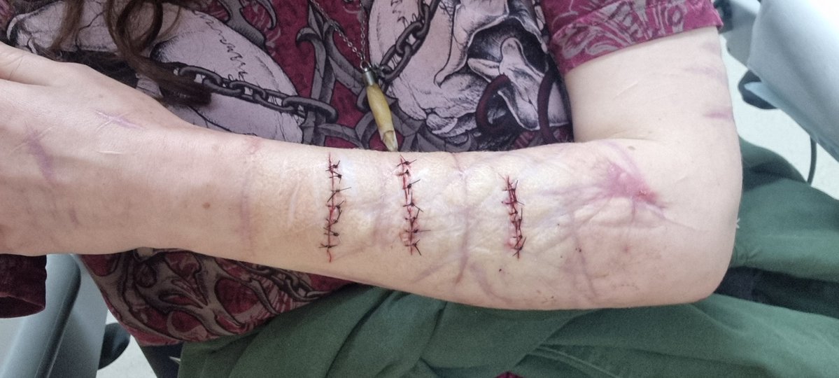 UnimportantLurk's tweet photo. Halloween makeup , certainly not real , definitely sfx . https://t.co/hvoYhGVK8I