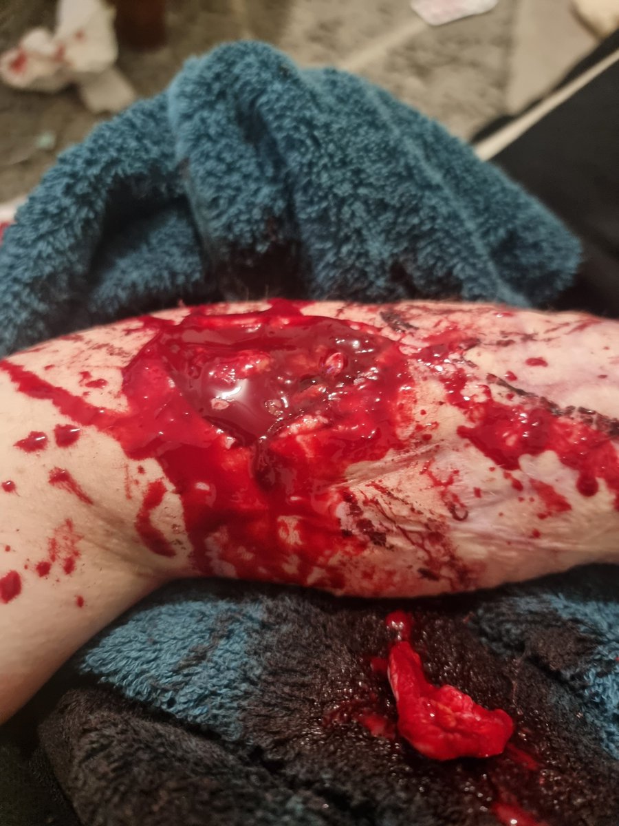 UnimportantLurk's tweet photo. Halloween makeup , certainly not real , definitely sfx . https://t.co/hvoYhGVK8I