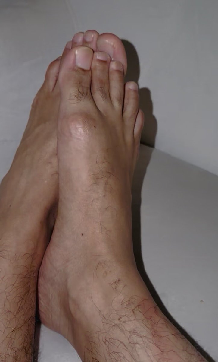 steph69182's tweet photo. @Myla_feet Feet 👣 https://t.co/CO5gmMwiIk