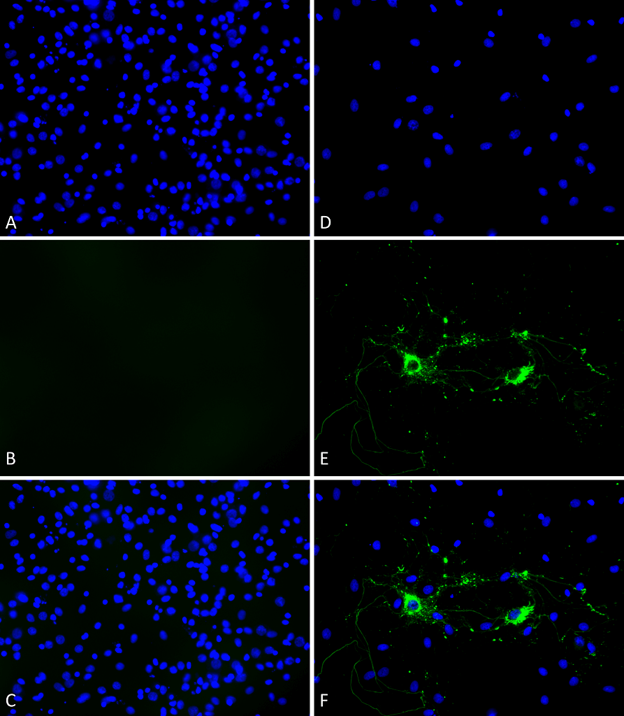 StressMarq's tweet photo. Product citation 💡 

A*STAR IMCB researchers used StressMarq's #AlphaSynuclein PFFs, Oligomers, &amp; Monomers to develop a GI-targeted peptide probe, advancing peptide-based diagnostics for #PD. 

Proteins ➡️ https://t.co/8w8PctCxRR 
Paper 📖 https://t.co/p2NfoglJAL https://t.co/GNqeZIaUn8