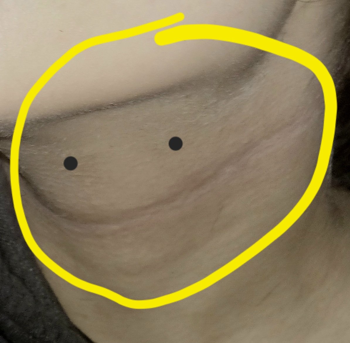 hannibalsman's tweet photo. Hey its me, its Neckity  

#suicidetwt #988twt #shrtwt #ouchietwt #sledtwt #venttwt  #promotwt #moothunt https://t.co/MGJ9iXhrJS
