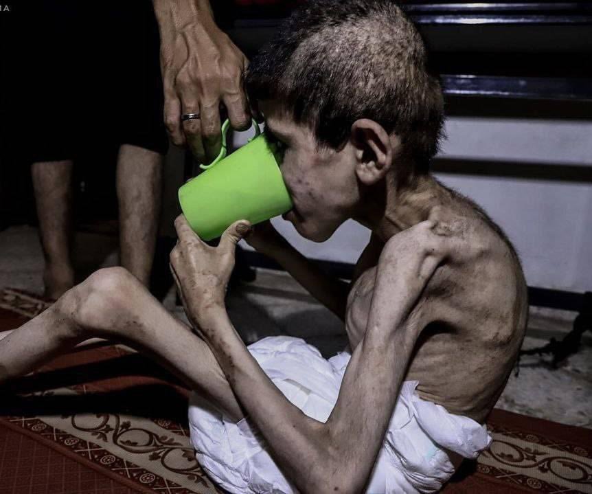AHMED_ABUHAMAD_'s tweet photo. وا��لهِ ستُسألون … أتظنون أنكم ستهربون ؟

هناك جائعون يستغيثون، وهناك من يستطيع أن يُعين .

فلا تظنوا أن المشهد سيمضي بلا سؤال …
ولا أن وجع المظلوم سيُنسى . https://t.co/PjsnJPl3Gn