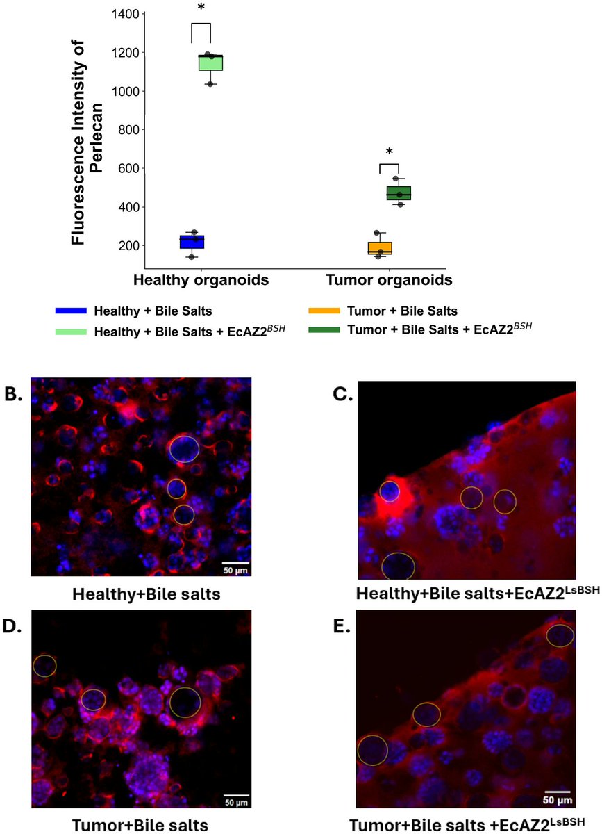 ABMEjournal's tweet photo. The way gut bacteria process bile salts may influence colorectal cancer, but exactly how these microbial activities affect intestinal tissue is not well understood.

Exploring this relationship, researchers developed a controlled co-culture platform combining healthy and tumor-derived colon organoids with an engineered Escherichia coli strain that produces bile salt hydrolase.

The engineered bacteria preferentially colonized tumor organoids and restored farnesoid X receptor signaling in healthy organoids, while tumor organoids resisted this effect. The researchers also found that bile salt exposure and bacterial colonization had opposing effects on Hspg2, a gene associated with bacterial attachment to the intestinal surface.

These findings suggest that cancerous tissue may respond differently to bacteria-driven changes in bile salts – a distinction that could be leveraged in designing more selective therapies.

𝗥𝗲𝗮𝗱 𝗺𝗼𝗿𝗲: https://t.co/J3yBTixATZ

𝗦𝘁𝘂𝗱𝘆: Bile Salts and Bacterial Bile Salt Hydrolase Activity Influence Escherichia coli Colonization and FXR Signaling in Colorectal Cancer Organoids

𝗔𝘂𝘁𝗵𝗼𝗿𝘀: Ishita Dasgupta, Arianna Brevi, Yixiao Ma, Durga Prasad Rangineni, Miriam Duran, Amir Zarrinpar, and Abhinav Bhushan

@illinoistech
@UCSanDiego
@Zarrinparlab

𝗦𝘂𝗯𝗺𝗶𝘁 𝘆𝗼𝘂𝗿 𝗺𝗮𝗻𝘂𝘀𝗰𝗿𝗶𝗽𝘁: https://t.co/Gyz8DNnMJO