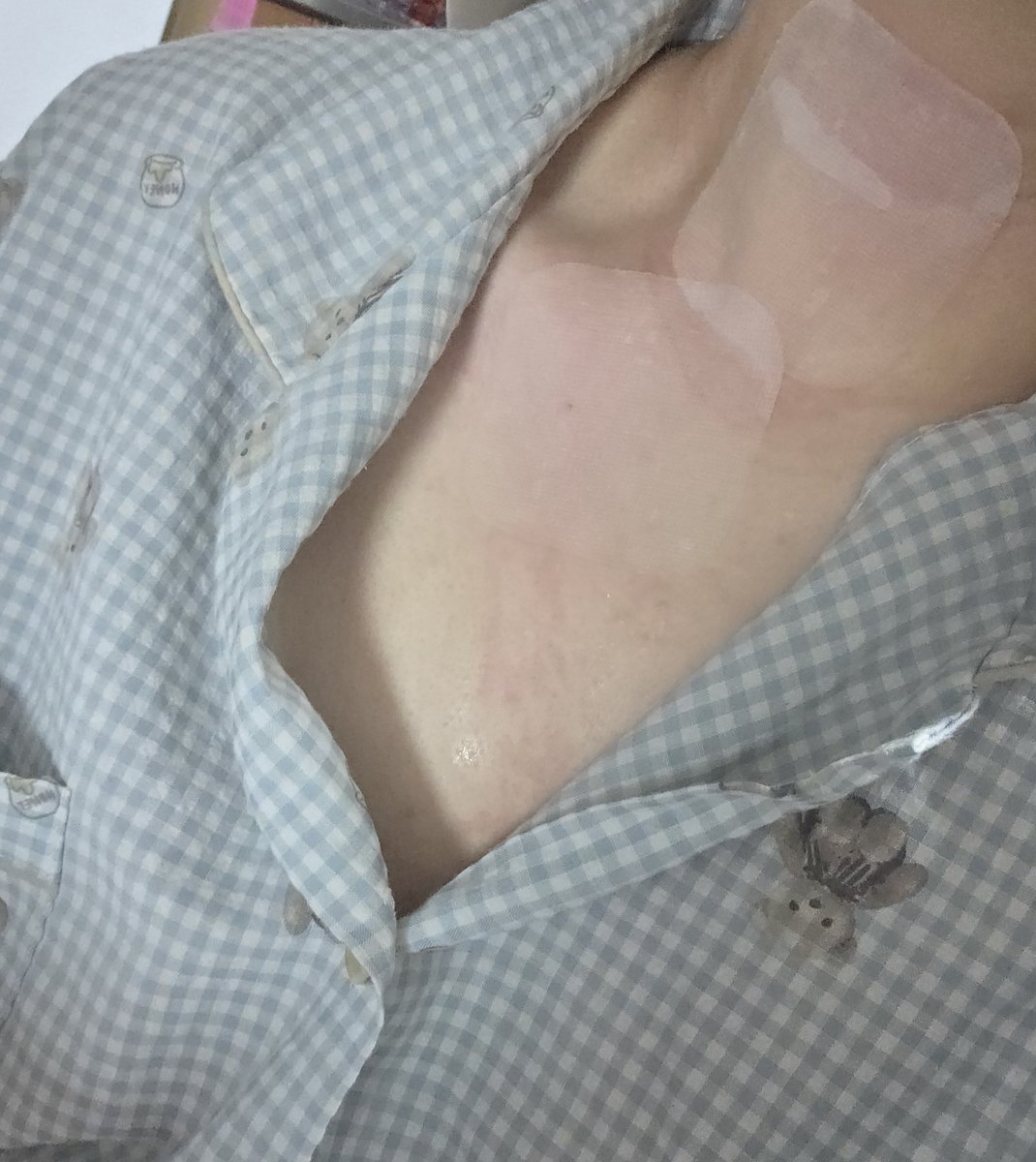 _lddubbu_'s tweet photo. 정체모를 간지러움이 가끔 있어서
그럴 때마다 티트리 패드 올려둠;;
얼굴 보다 몸에 3배로 쓰기
간지러워용 https://t.co/6SnwaLKkex