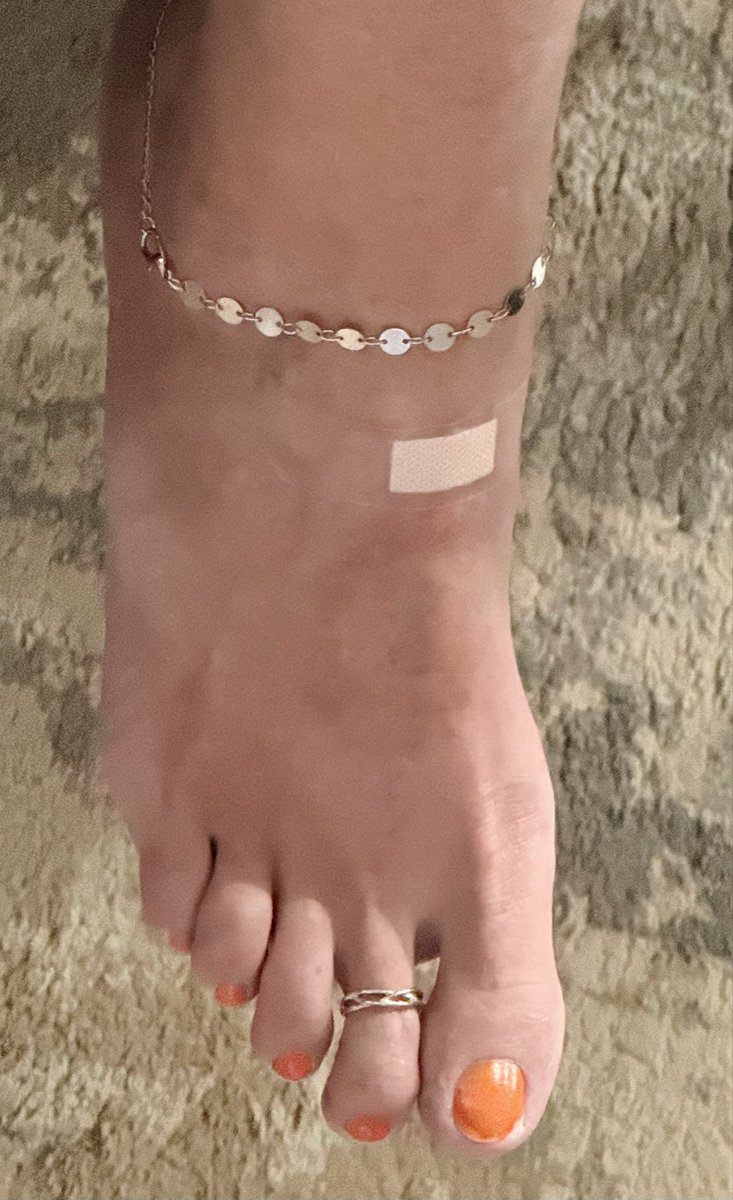 Mike_n_Manda's tweet photo. Who wants to kiss her booboo?
#feet #feetfetish #booboo #footmistress https://t.co/Ft31ux5yeG