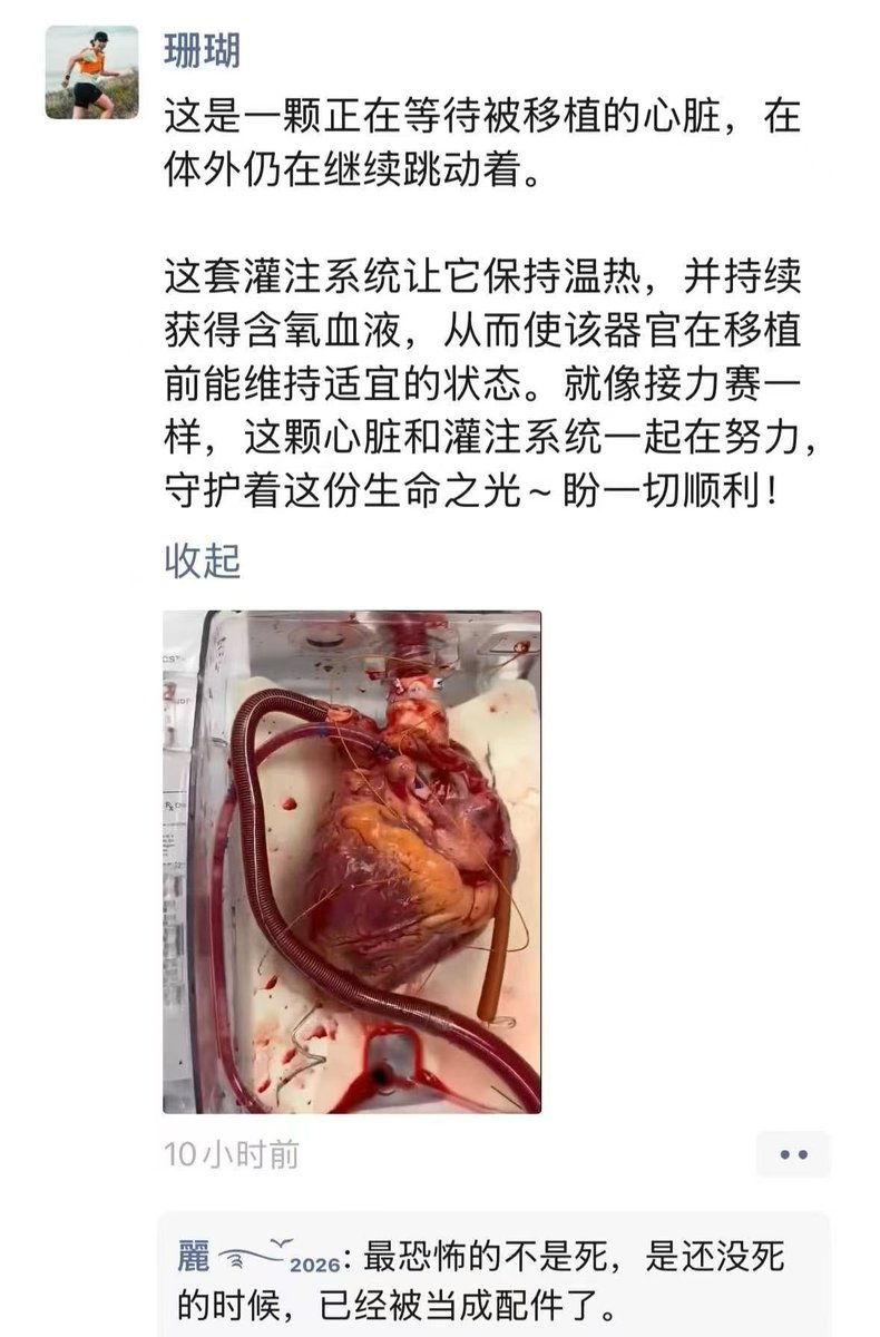 huang3feng's tweet photo. 这不是一颗普通的心脏，它的背后一定是有一个人的生命被剥夺，或许就是一个赤裸裸的杀人故事！ https://t.co/mtkcfJ6uW1
