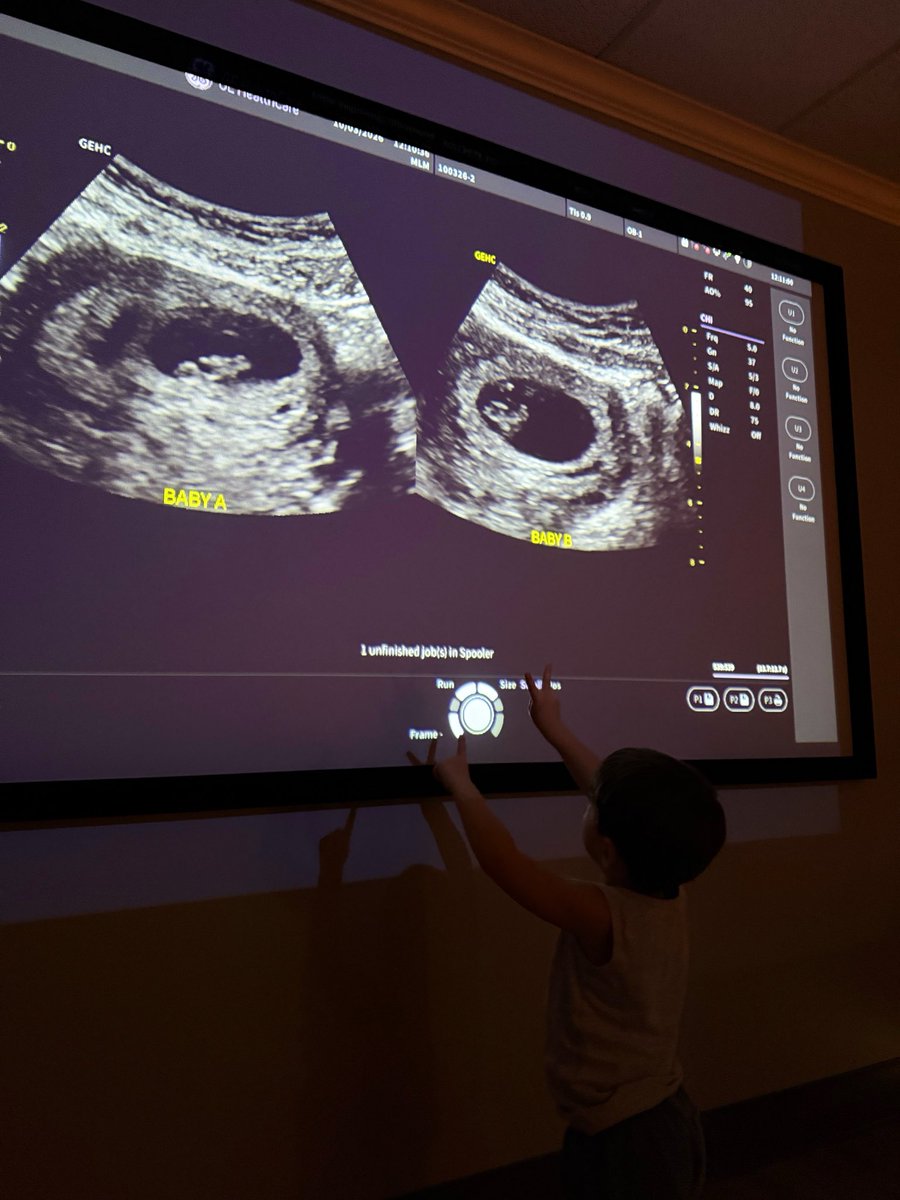 NICKMERCS's tweet photo. Fellas, some good news!
We’re having twins! 
4 under 4! 👨🏻‍🍳💪🏼 https://t.co/8YXPsxXYVq