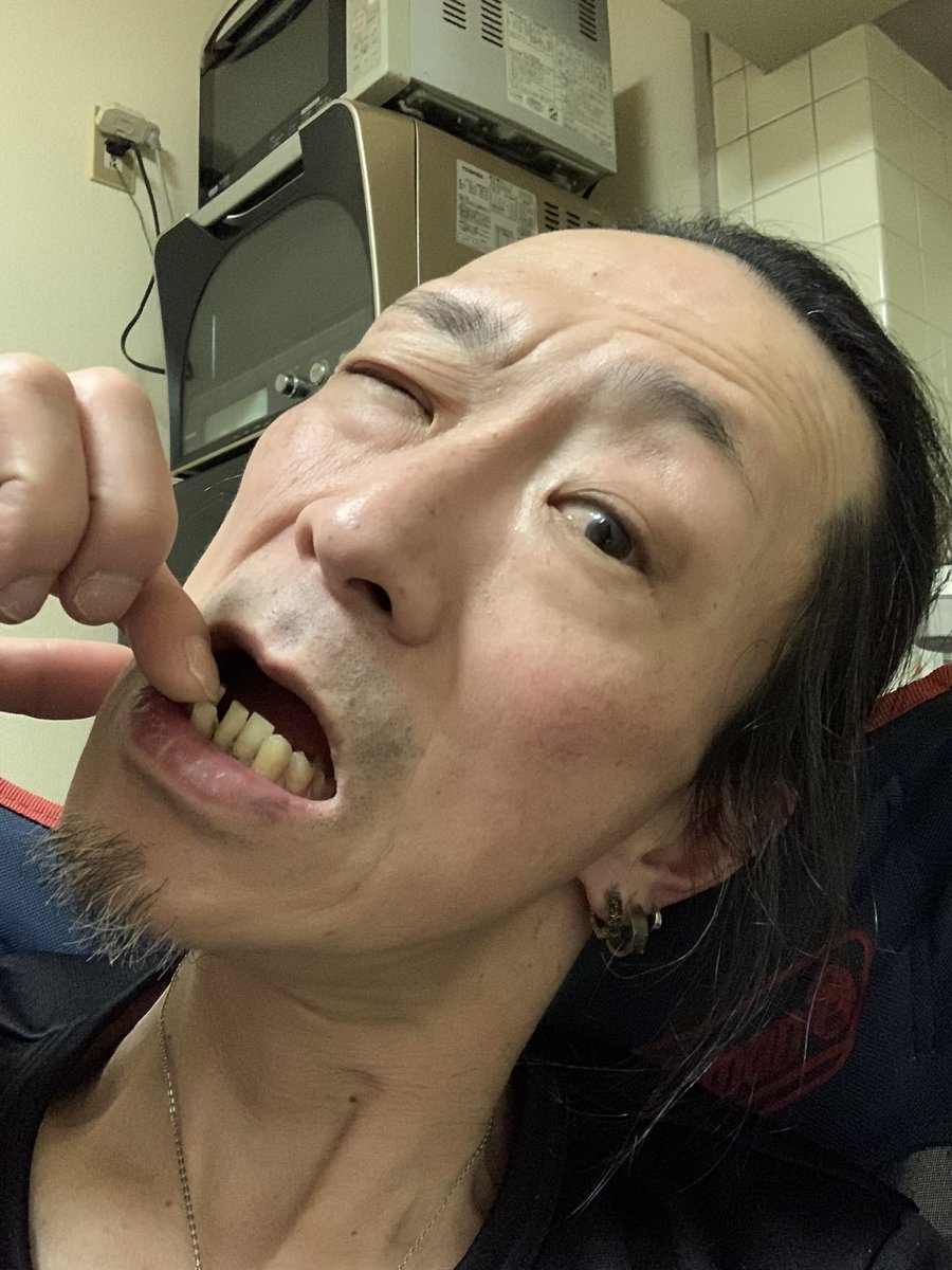 ichinosuke0303's tweet photo. 僕にとって、柿ピーを食べるリスクは尋常じゃない！
前歯が無くなる可能性大‼️
お見せできませんが、
この写真以降も…八重歯欠損
月曜日から夜更かしに、
インタヴューされそうなレベルです。爆笑 https://t.co/m8AfjV0nYX