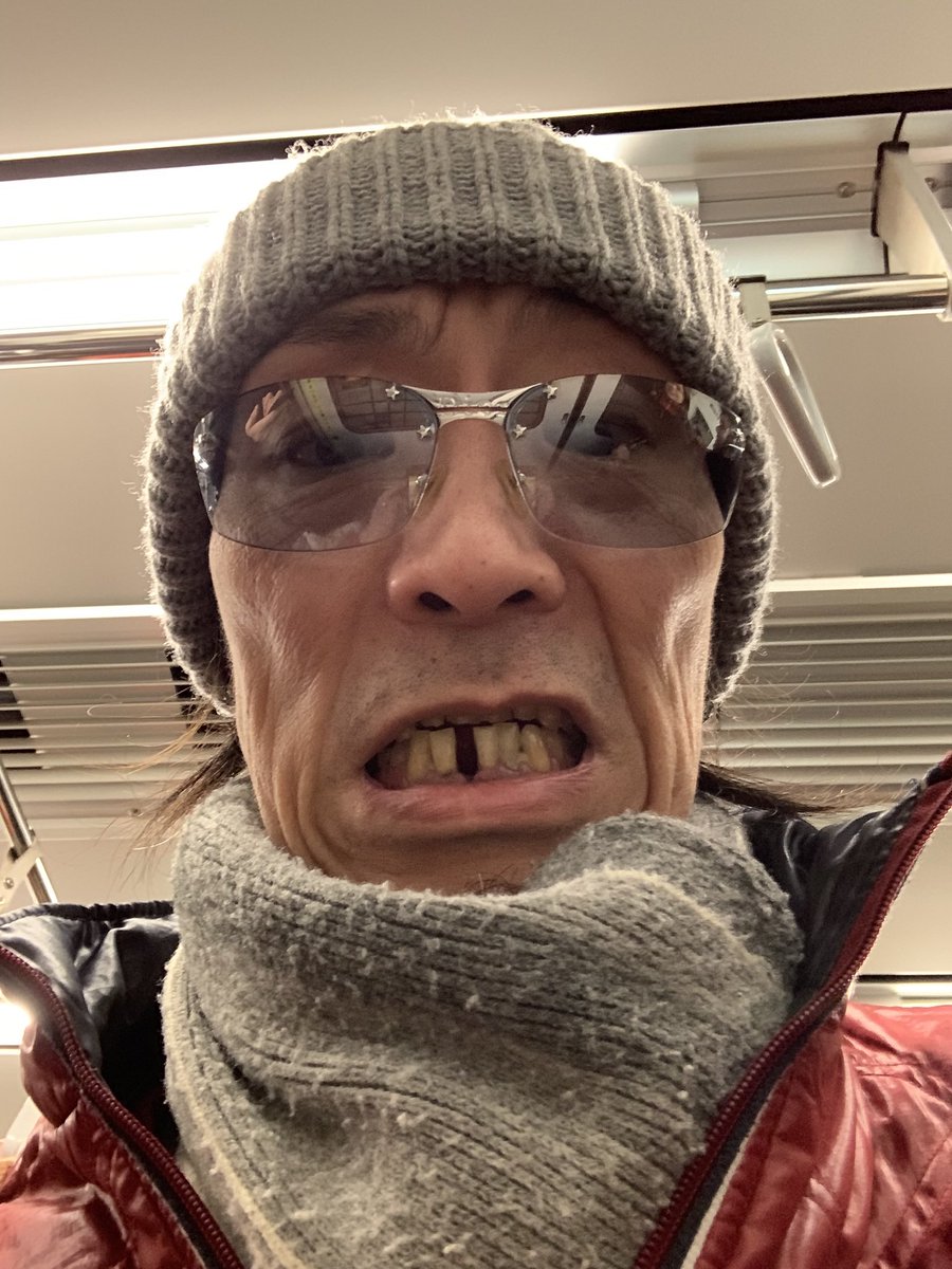 ichinosuke0303's tweet photo. 僕にとって、柿ピーを食べるリスクは尋常じゃない！
前歯が無くなる可能性大‼️
お見せできませんが、
この写真以降も…八重歯欠損
月曜日から夜更かしに、
インタヴューされそうなレベルです。爆笑 https://t.co/m8AfjV0nYX