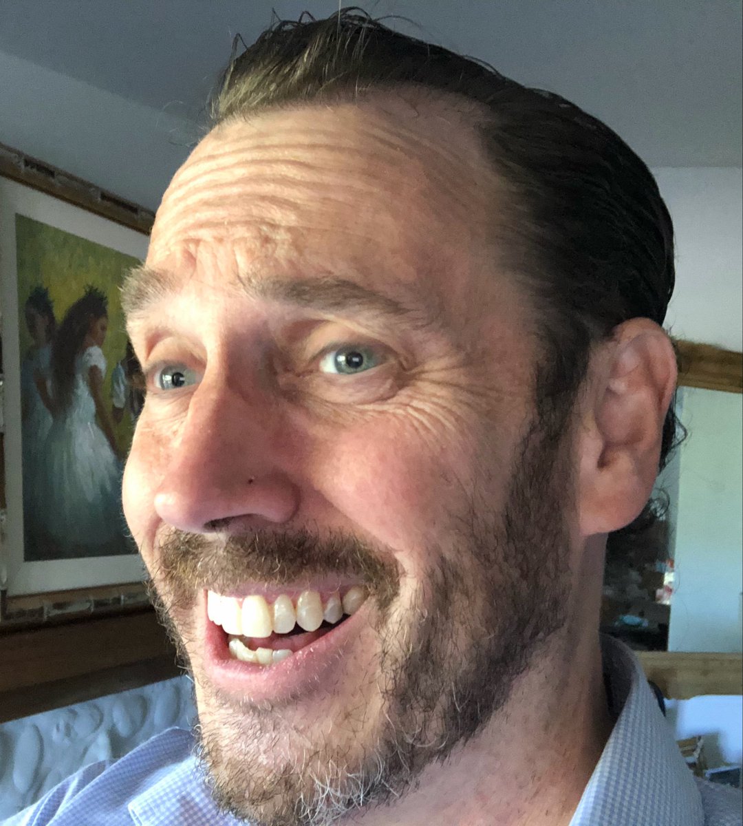 Clavuncular's tweet photo. Before &amp; After

Facial posture is everything https://t.co/25wsY0mz84