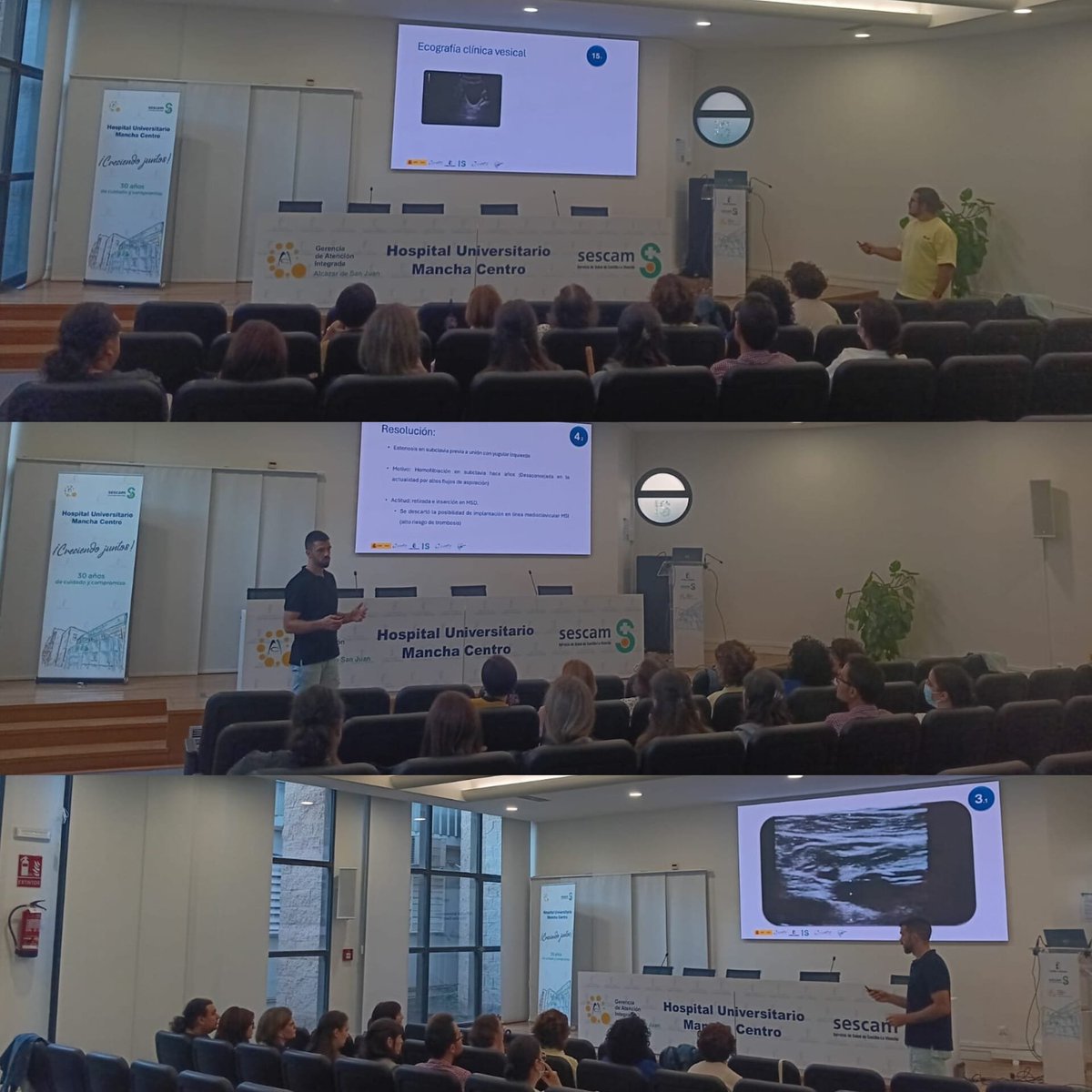 eco_scamfyc's tweet photo. 📡 Seguimos haciendo ECO! 🔎
👇
Segunda sesión presencial de Ecografía Avanzada para Enfermería Familiar y Comunitaria del @sescamcl @ignaciomsb y @scamfyc 
📌 Hospital Universitario Mancha Centro, Alcázar de San Juan.
💪🏽 Formación práctica, aprendizaje compartido y ganas de más! https://t.co/cbdUYD9KZ4