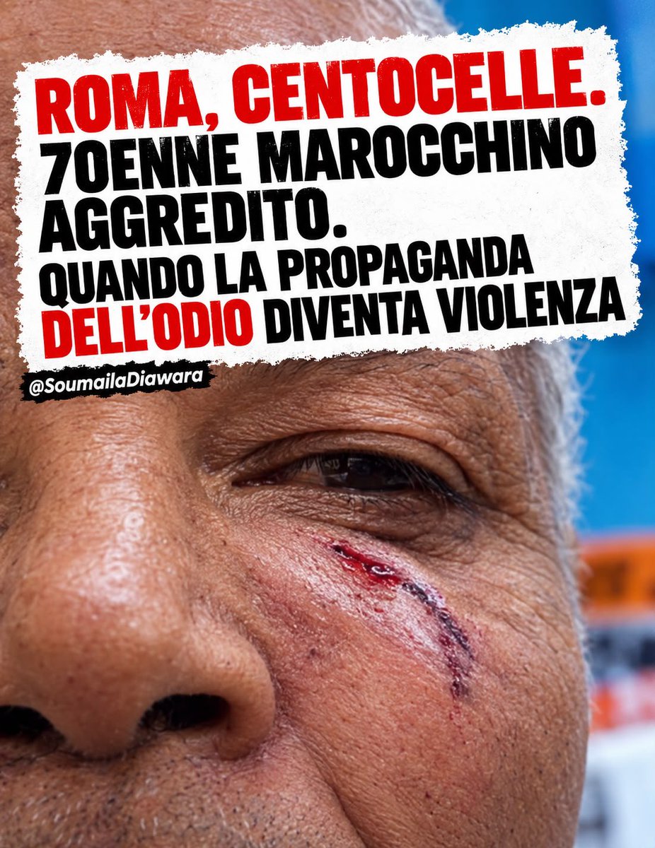 soumi_ds's tweet photo. Un uomo marocchino di 70 anni denuncia di essere stato aggredito a Centocelle mentre parlava al telefono.

Prima gli insulti razzisti. Poi un colpo al volto e quelle parole: «Marocchino di m…, devi tornare al tuo Paese. Remigrazione».

Trenta giorni di prognosi.

Se quanto denunciato verrà confermato, non saremo davanti a una semplice aggressione. Saremo davanti a un episodio che chiama in causa anche il clima politico e culturale nel quale questa violenza può maturare.

Perché le parole non vivono nel vuoto.

Quando per anni si ripete che alcune persone sono “di troppo”, che devono essere mandate via, espulse, rimpatriate, che la loro presenza rappresenta un problema da eliminare, si costruisce una gerarchia tra chi avrebbe il diritto di stare e chi invece dovrebbe sparire.

E quando la parola “remigrazione” esce dai comizi, dai social e dalla propaganda politica e viene urlata contro un uomo di 70 anni mentre gli viene sferrato un pugno, qualcosa dovrebbe farci riflettere.

Non basta condannare il pugno.

Bisogna interrogarsi anche sulle parole che possono preparare il terreno alla violenza.

Perché il razzismo non comincia con un pugno. Comincia molto prima: quando un essere umano viene trasformato in un problema, uno straniero in un intruso, una persona in un corpo da espellere.

Nessuna propaganda può rendere normale l’idea che qualcuno debba “tornare al proprio Paese” perché ha un cognome marocchino o un’origine straniera.

Un uomo di 70 anni non deve chiedere il permesso a nessuno per camminare nelle strade della città in cui vive. Non deve dimostrare di essere abbastanza italiano. Non deve giustificare la propria esistenza.

E soprattutto non deve avere paura di essere aggredito perché qualcuno ha deciso che la sua origine lo rende meno umano degli altri.

La democrazia si difende anche per strada, ogni volta che rifiutiamo l’idea che esistano persone di serie A e persone da tollerare, allontanare o cacciare.

Per questo, se la dinamica denunciata sarà confermata, non chiamatelo semplicemente “episodio di cronaca”.

Chiamatelo per quello che è: razzismo trasformato in violenza.

Il razzismo si denuncia prima che diventi un pugno.