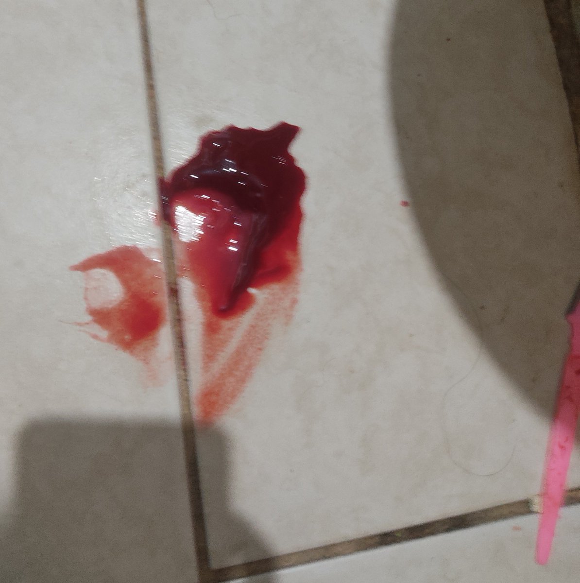 Enfermo_771's tweet photo. ....Y todavía tire el resto de sangre... https://t.co/rmIfMnbKam