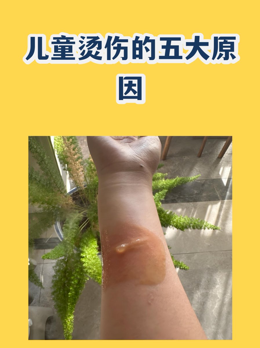 6209f_610's tweet photo. Cough, shout, scald, nephew, don’t rush, take care! https://t.co/Vmpk7haI5M