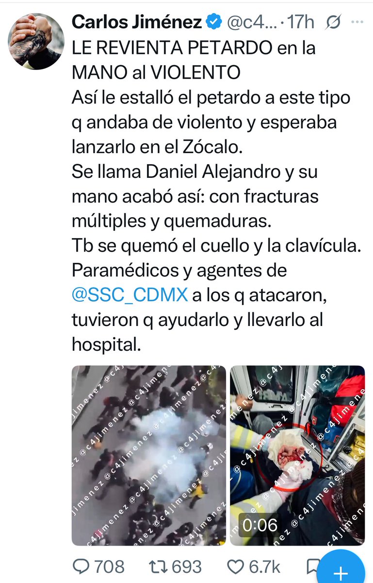 c4jimenez's tweet photo. QUE VAN a PEDIR DONATIVOS para EL Q le ESTALLÓ un PETARDO en LA MANO
Así están anunciando sus compañeros lo q le pasó a Daniel Alejandro durante la marcha del 2 de Octubre.
Mientras atacaba a policías, le explotó el petardo.
Los mismos elementos de @SSC_CDMX y ERUM lo ayudaron.
Así quedó su manita desconchabadita.