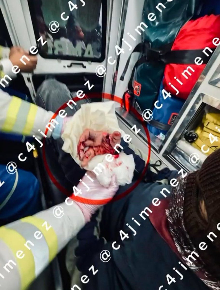 c4jimenez's tweet photo. QUE VAN a PEDIR DONATIVOS para EL Q le ESTALLÓ un PETARDO en LA MANO
Así están anunciando sus compañeros lo q le pasó a Daniel Alejandro durante la marcha del 2 de Octubre.
Mientras atacaba a policías, le explotó el petardo.
Los mismos elementos de @SSC_CDMX y ERUM lo ayudaron.
Así quedó su manita desconchabadita.
