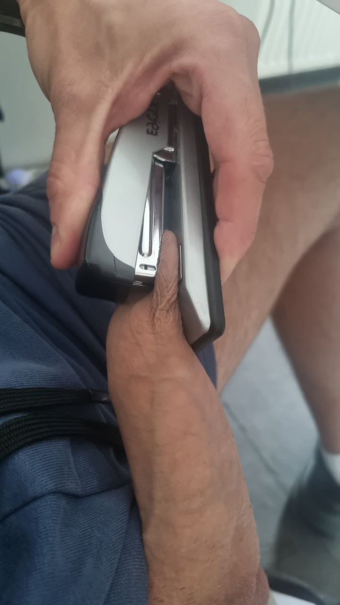 newfeminist337's tweet photo. If you have an uncircumcised penis and a set of fat nuts, that should be your daily routine 
Why? You know better than anyone that you'd be better off without them, so let's work on it 😉 https://t.co/Qt96auzpCQ