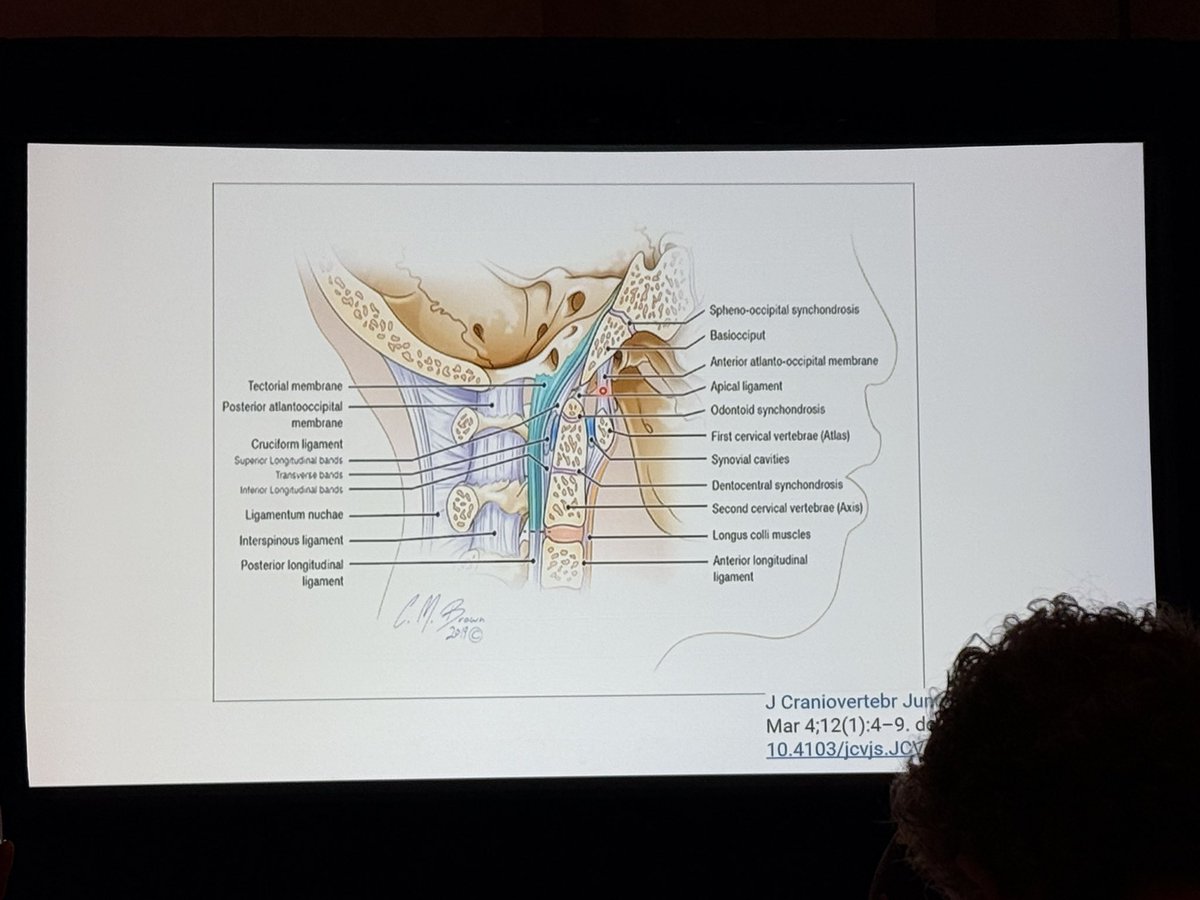 The_ASSR's tweet photo. Unstable craniocervial spine fractures at #WNRS26 with @Charles_Li_MD with a great anatomy review and interesting cases!
@radiology_ninja @KSeifertMD https://t.co/TrPFZwOD5A