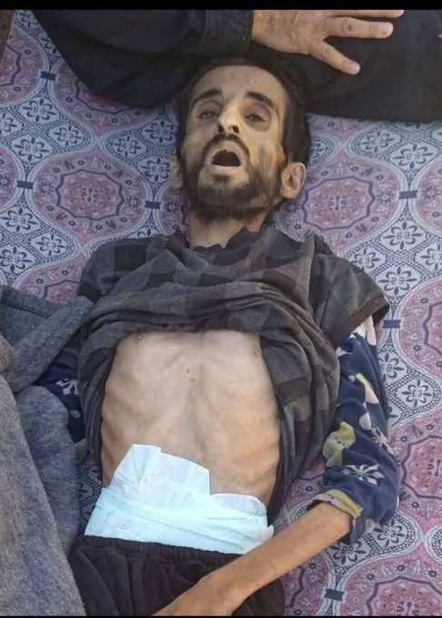 IbrahimHuda12's tweet photo. لم تحرك هذه المشاهد فيك ساكناً، فابحث عن قلبك في ركام النسيان.. 💔

وجع فلسطين ليس مجرد خبر عابر، بل هو اختبار يومي لإنسانيتنا. كيف نغفو  والعالم يضيق بهم؟ 🌱🇵🇸

​صوتكم أمانة.. لا تتوقفوا عن النشر. 📢🇵🇸 https://t.co/BYphyciiaj