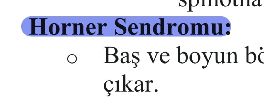 Sofben0146's tweet photo. Lan bu benim arkadaşım ahmet https://t.co/CRQuj1VtvP