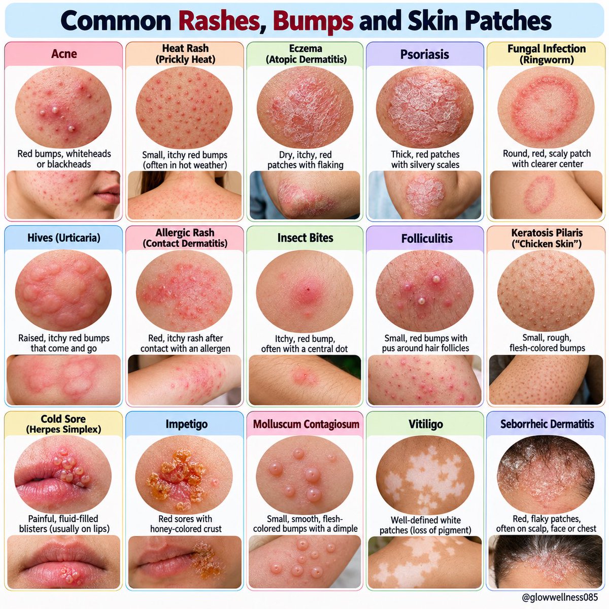 glowwellness085's tweet photo. 🚨 Your skin is trying to tell you something! https://t.co/EcrQKcj3ZR