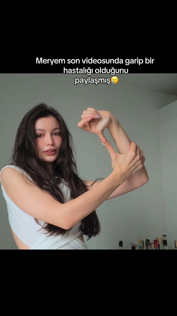 A woman with long dark hair in a white top holds up her hand while Turkish text reads 'Meryem son videosunda garip bir hastalığı olduğunu paylaşmış'.