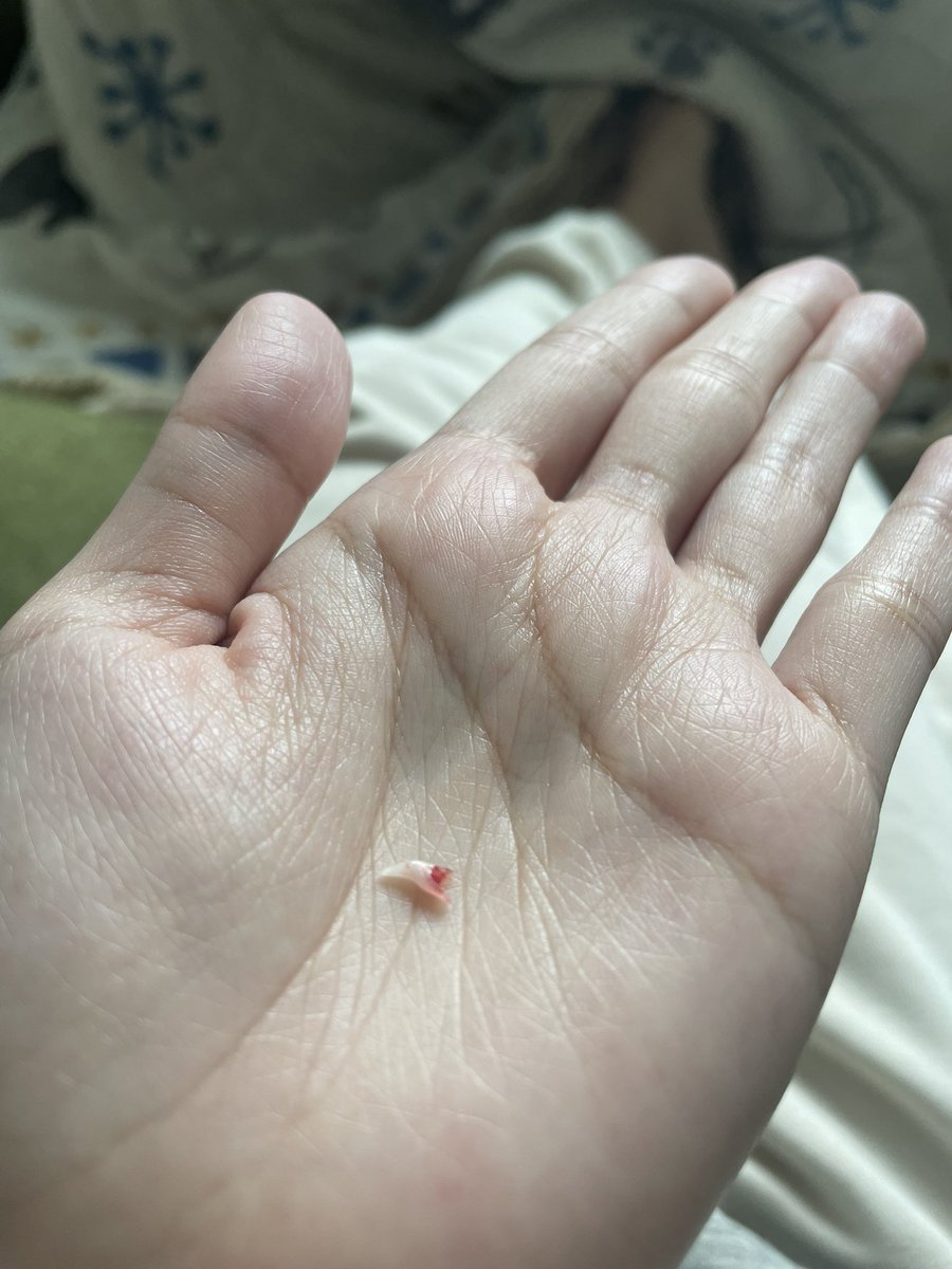 Honohvz's tweet photo. 子猫の抜けた歯発見🦷
布団に血ついててびっくりしたー https://t.co/6fkxIelDZS